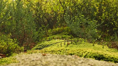 Person receiving acupuncture treatment for migraine relief