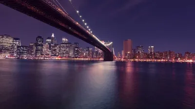 Thumbnail for Interstitial Cystitis/Painful Bladder Syndrome