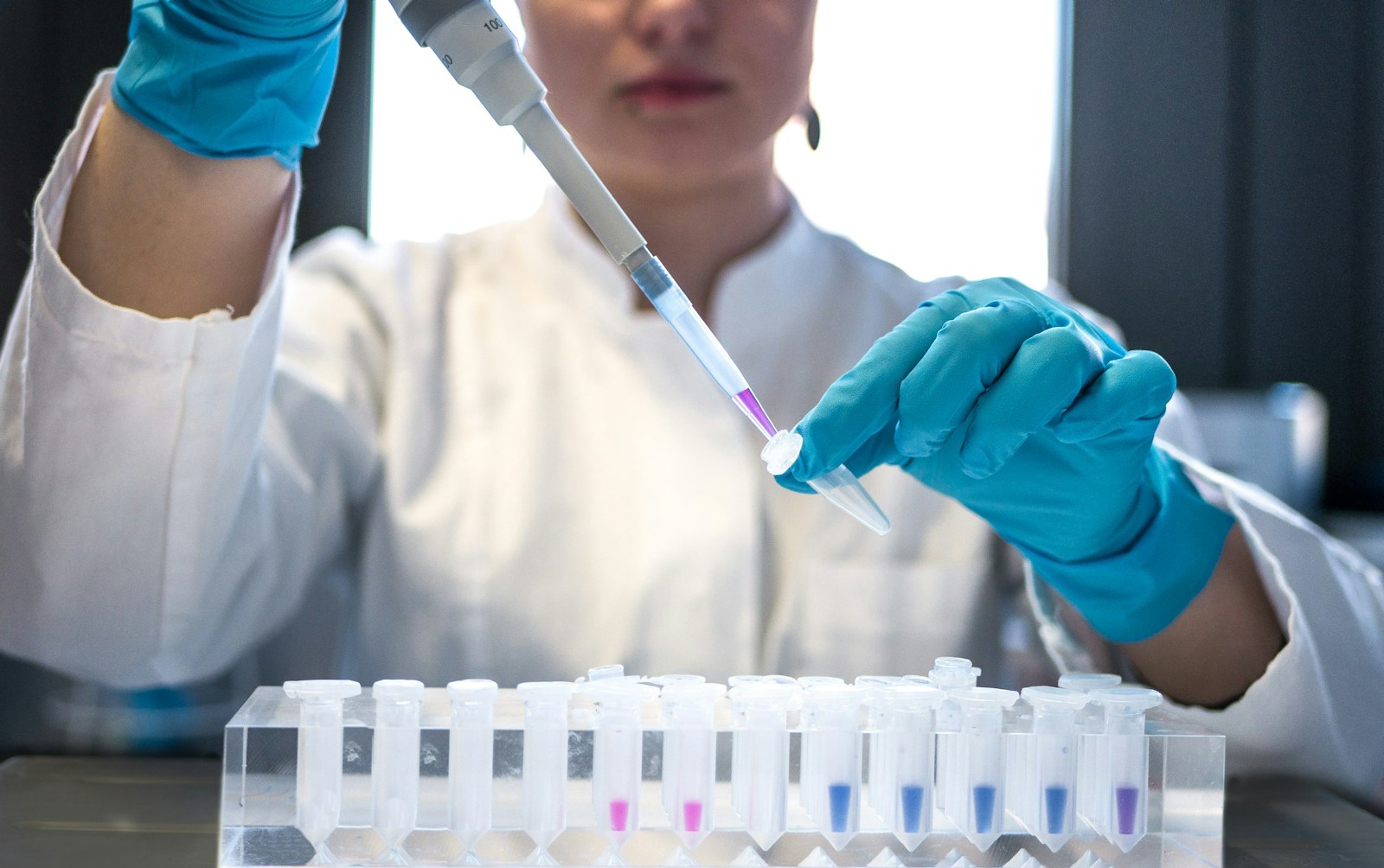 Scientist working with laboratory pipette and test tubes, representing the clinical research behind the MV140 UTI vaccine